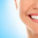 Blanqueamiento dental - Clínica dental Eixample