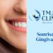 Sonrisa gingival - Barcelona TMJ Clinic