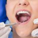 Empaste dental - TMJ Clinic