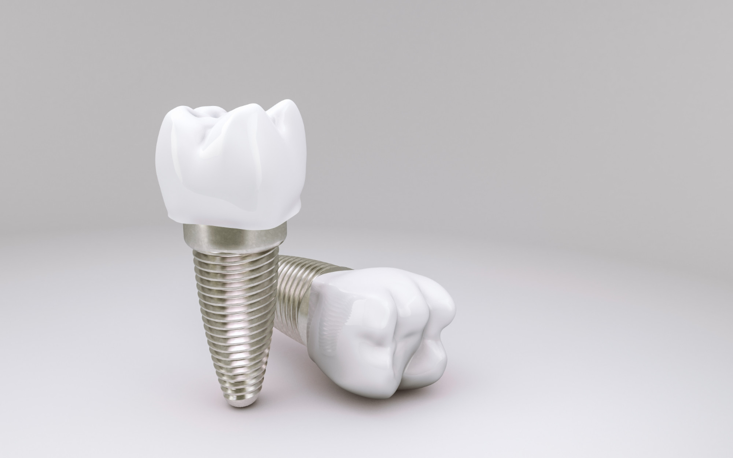 ¿En qué consisten los implantes dentales inmediatos?