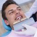 Hipoplasia dental - TMJ Clinic