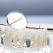 Implantes con poco hueso - TMJ Clinic