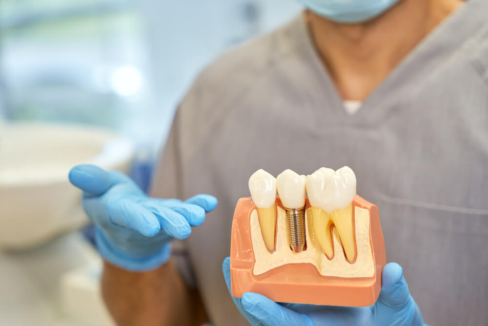 Beneficios para el paciente del uso de mallas subperiósticas en implantología dental.