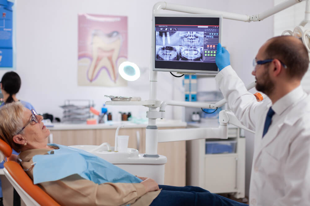 Beneficios de los implantes cigomáticos: una solución ideal para casos complejos.