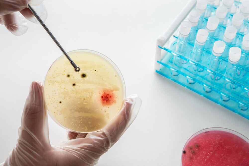 Cómo el microbioma periimplantario puede determinar el éxito o fracaso de un implante.