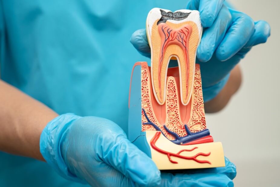 Principales lesiones y afecciones perirradiculares relacionadas con la pulpa dental.