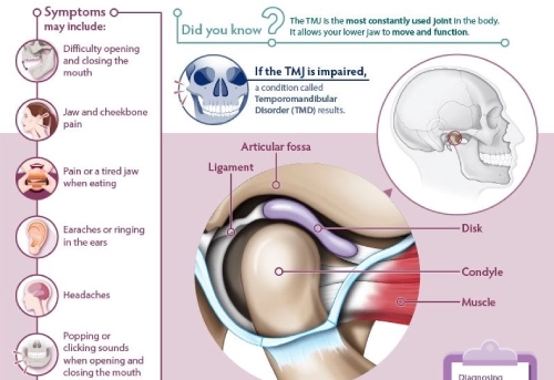 Tratamiento integral de la disfunción temporomandibular